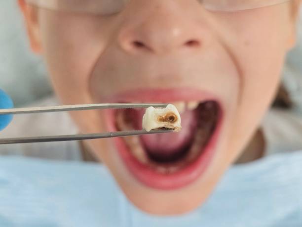 Best Emergency Gum Treatment in Fairdale, PA